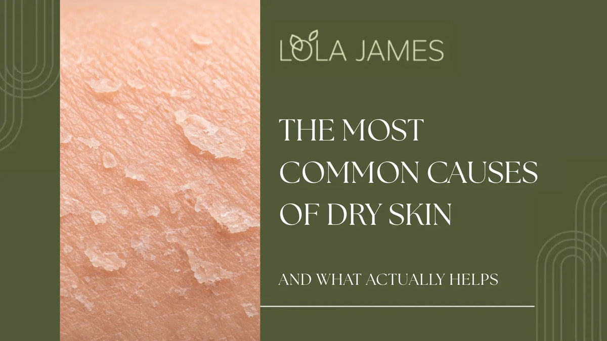 Why Is My Skin So Dry?
